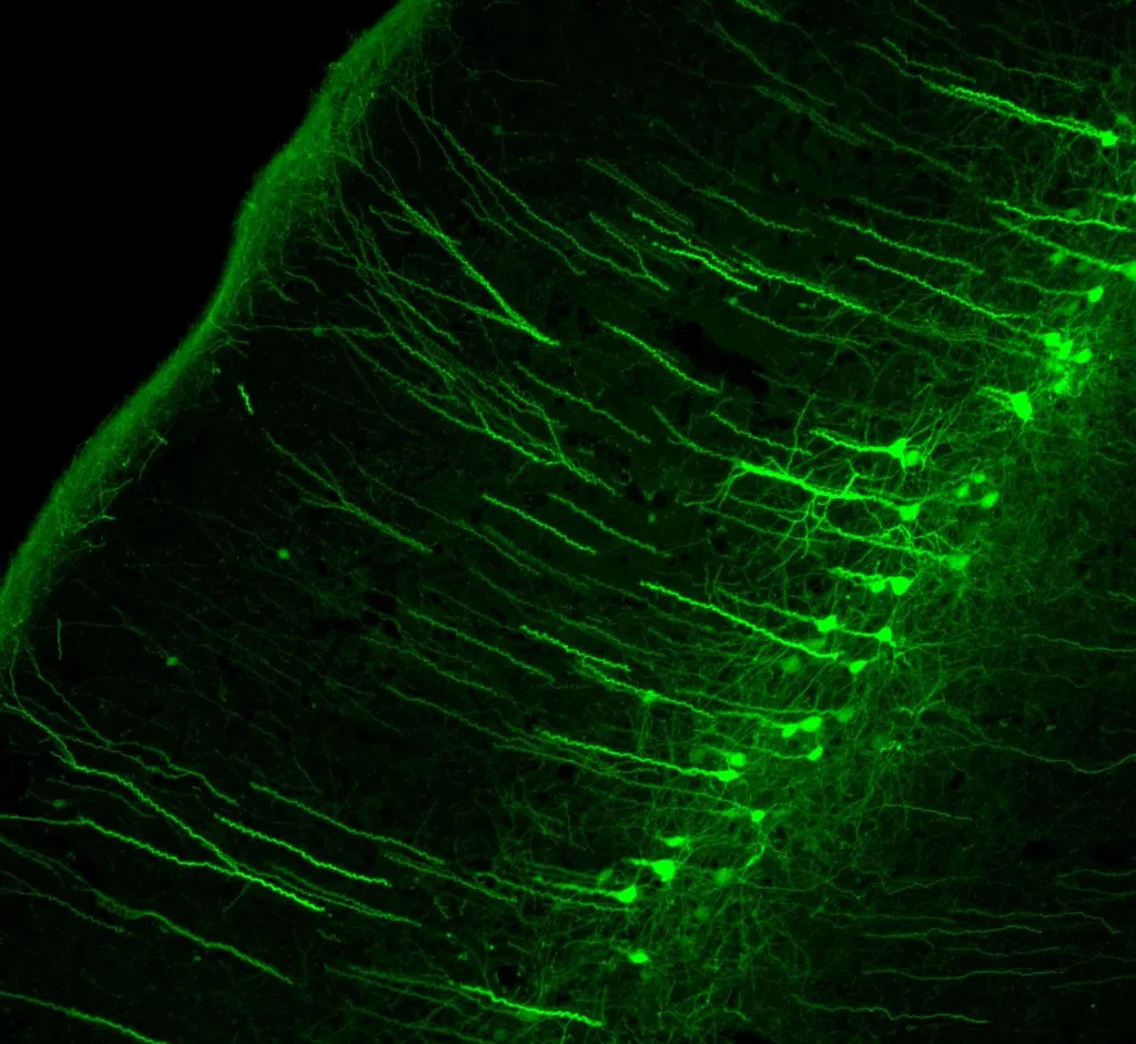Schofield-lab.cortical-cells-1024x941.jpg