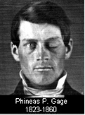 Phineas Gage