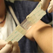 hydrogel bandage hydrogel bandage