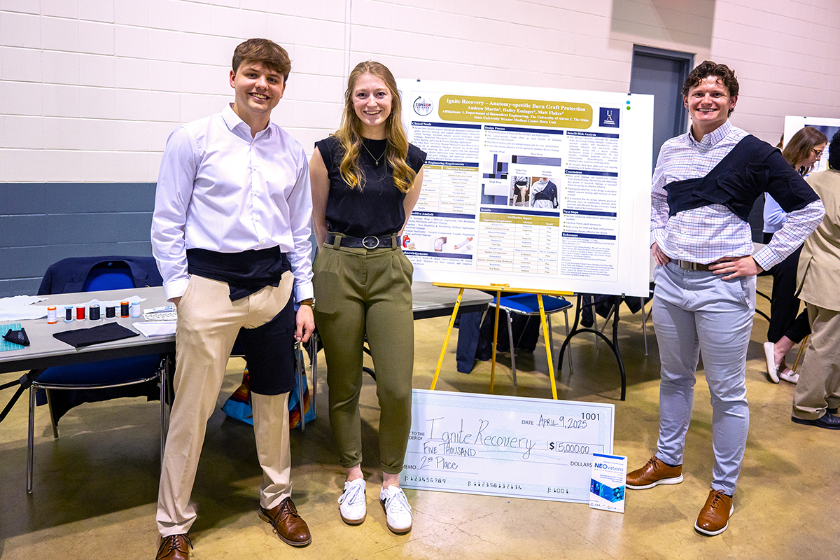 Turning pain into purpose: Engineering students create breakthrough burn bandage